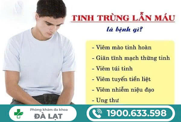 Hình ảnh minh họa